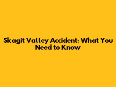 Skagit Valley Accident: What You Need to Know